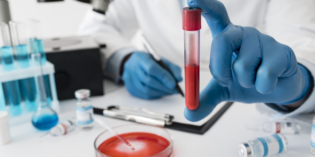 Convenient and Accurate Home Blood Test Bangalore Services: A Smarter Way to Health