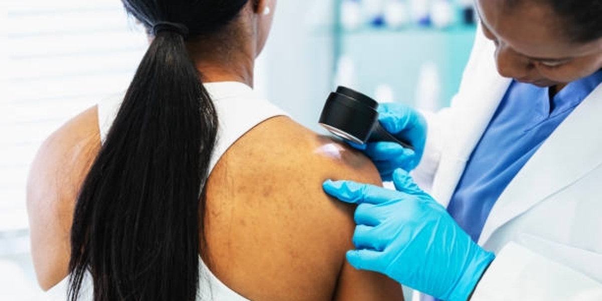 Acne Transformation Protocols: How Abu Dhabi Dermatologists Treat Resistant Cases