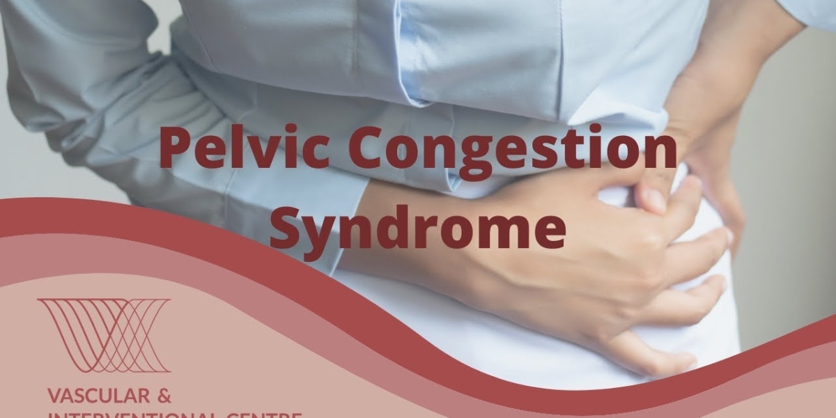 How Pelvic Congestion Syndrome Is Diagnosed and Treated in Albuquerque