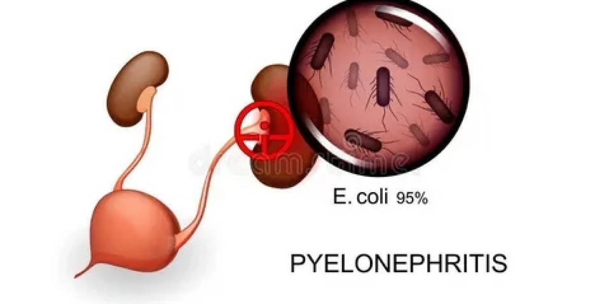 Vasectomy and AI-Powered Patient Counseling Platforms