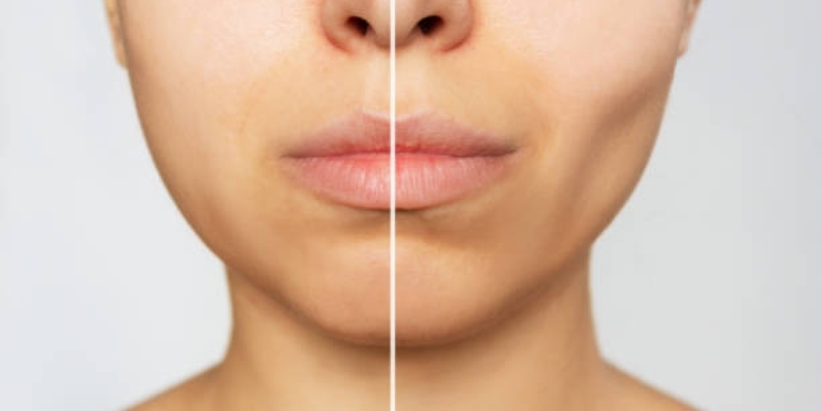 مخاطر عملية إجراء الغمازة في الرياض وكيف نتجنبها؟