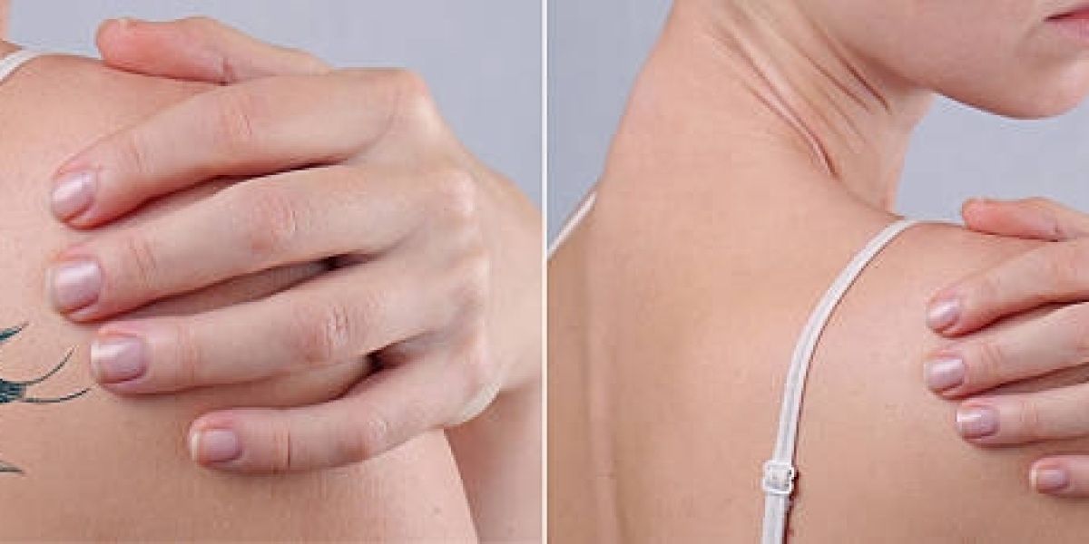 Master Tattoo Erasure with Laser Tattoo Removal