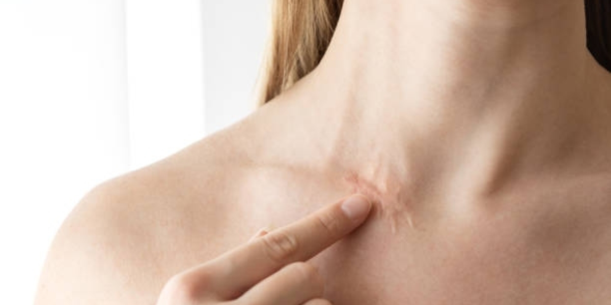 Defy Scars with Precision: Elite Scar Removal in Dubai