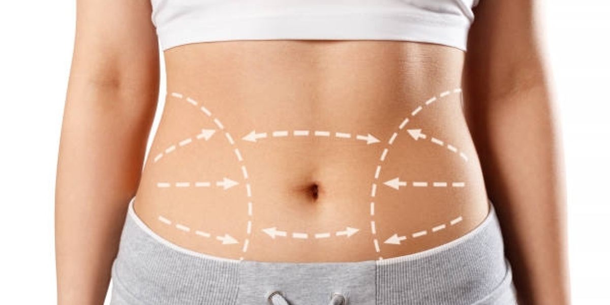 Liposuction Procedure Safety Measures You Should Know