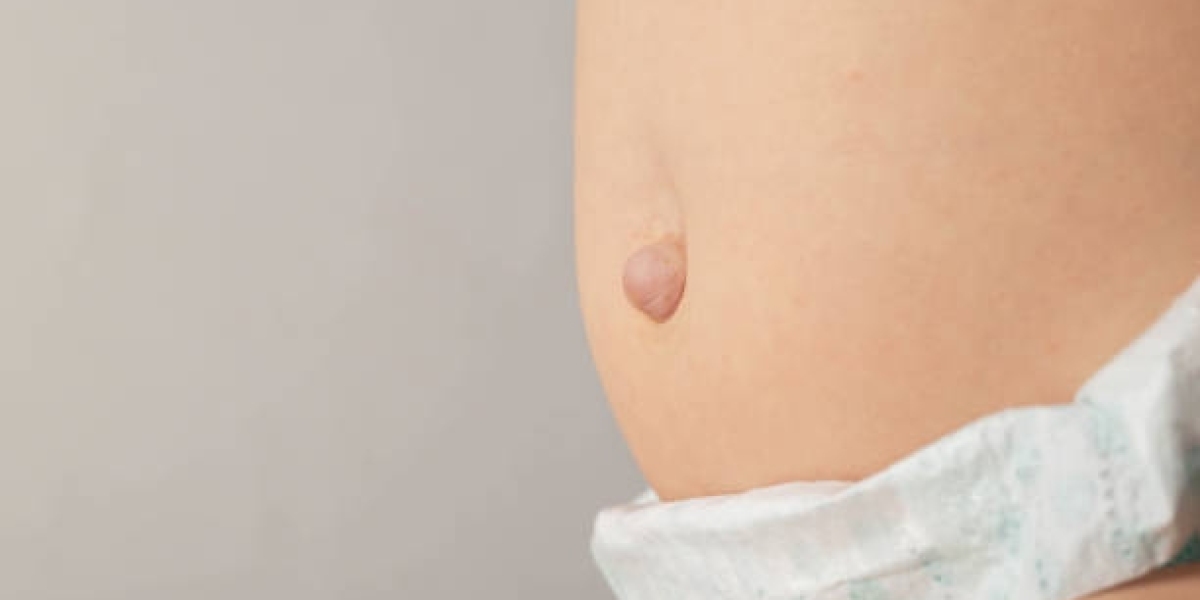 Hernia Surgery Explained for Patients Seeking Lasting Relief