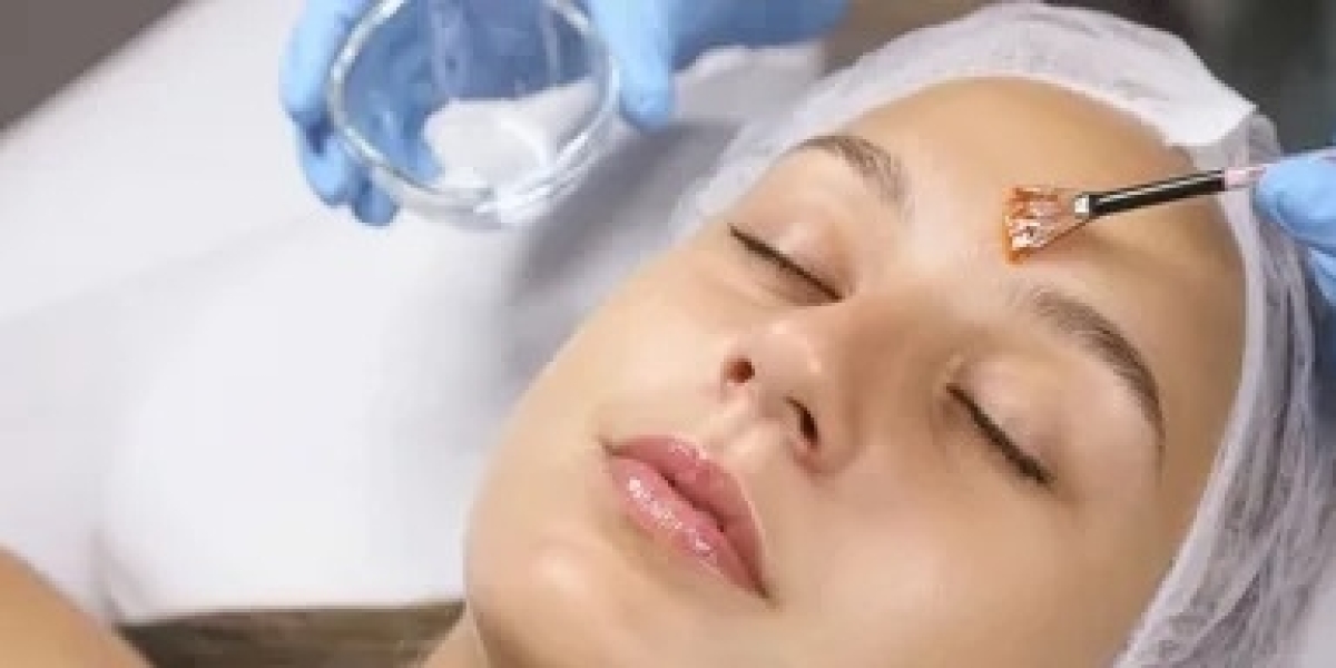 Can Chemical Peel in Islamabad Be Combined With Other Skin Treatments?