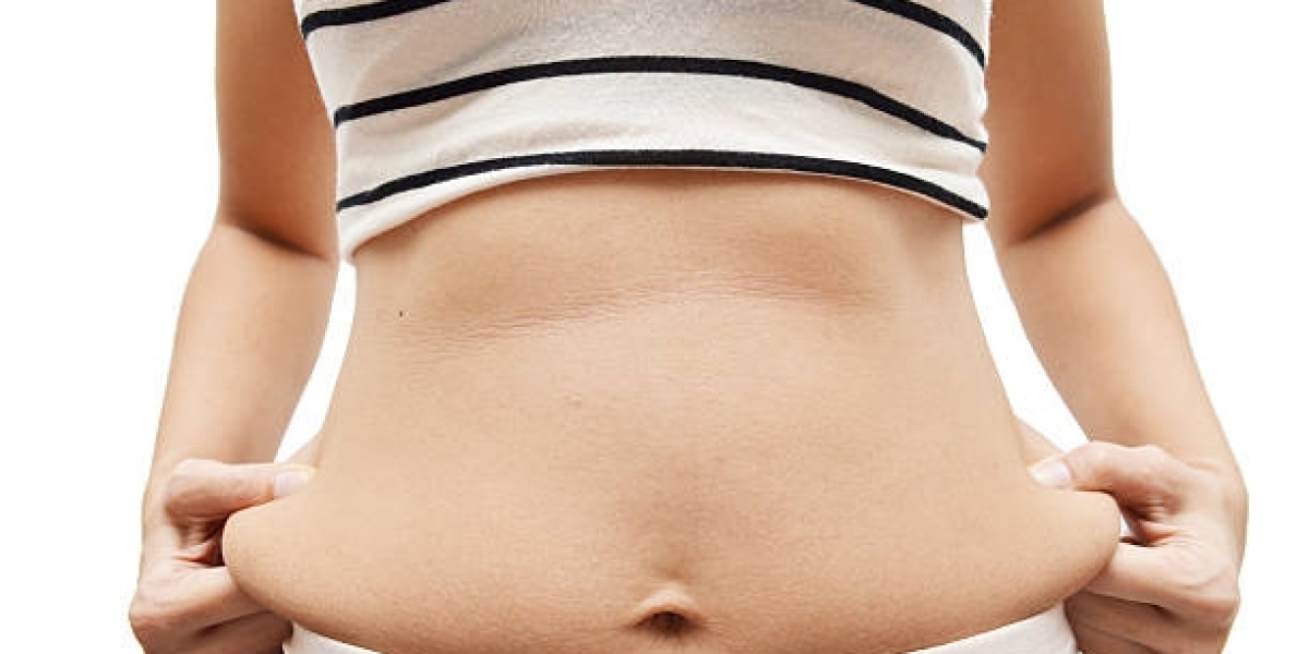 Tummy Tuck Surgery in Weight Loss Maintenance