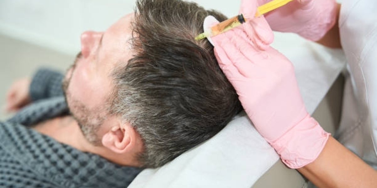 Preparing for Your PRP Hair Treatment Appointment