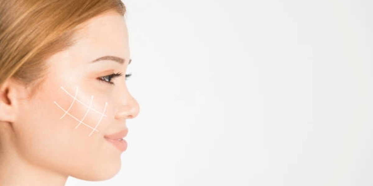 Cheek Augmentation in Dubai: Step-by-Step Process for Stunning Results
