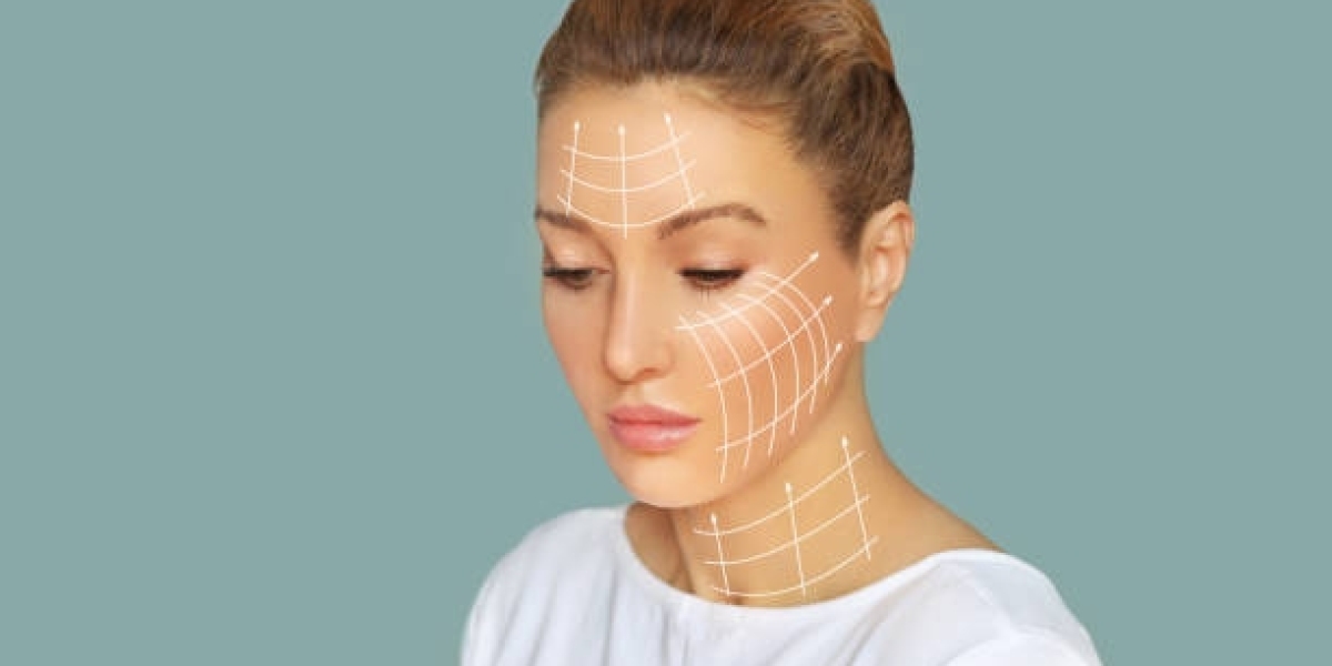 Silhouette Soft Thread Lift in Dubai: Real Patient Results and Reviews