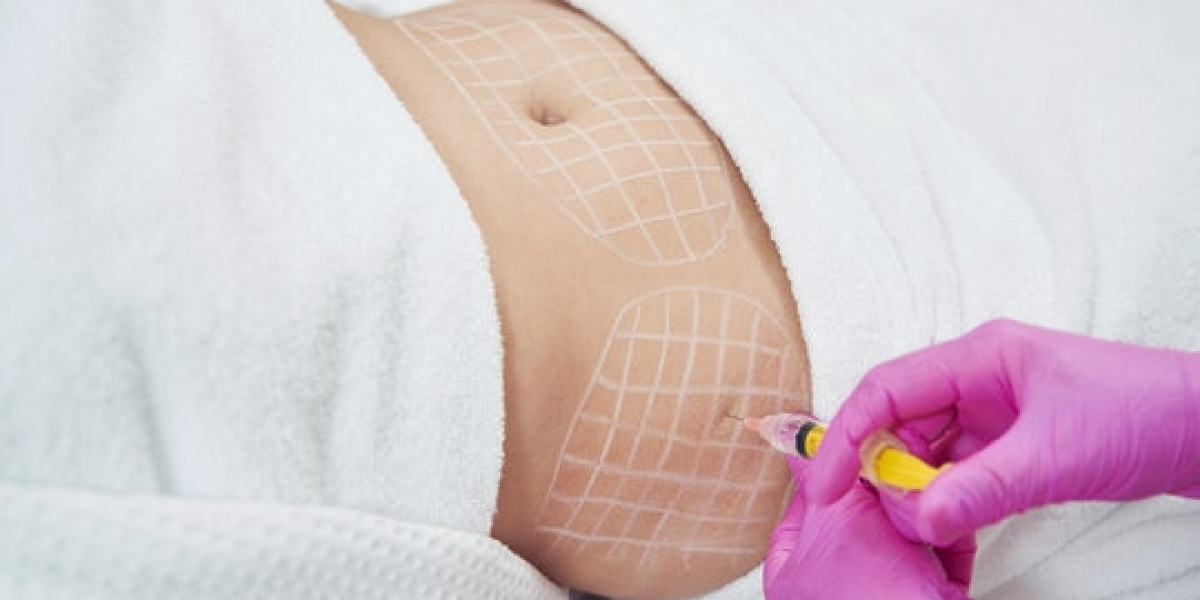 Preparing for Your First Fat Dissolving Treatment in Riyadh