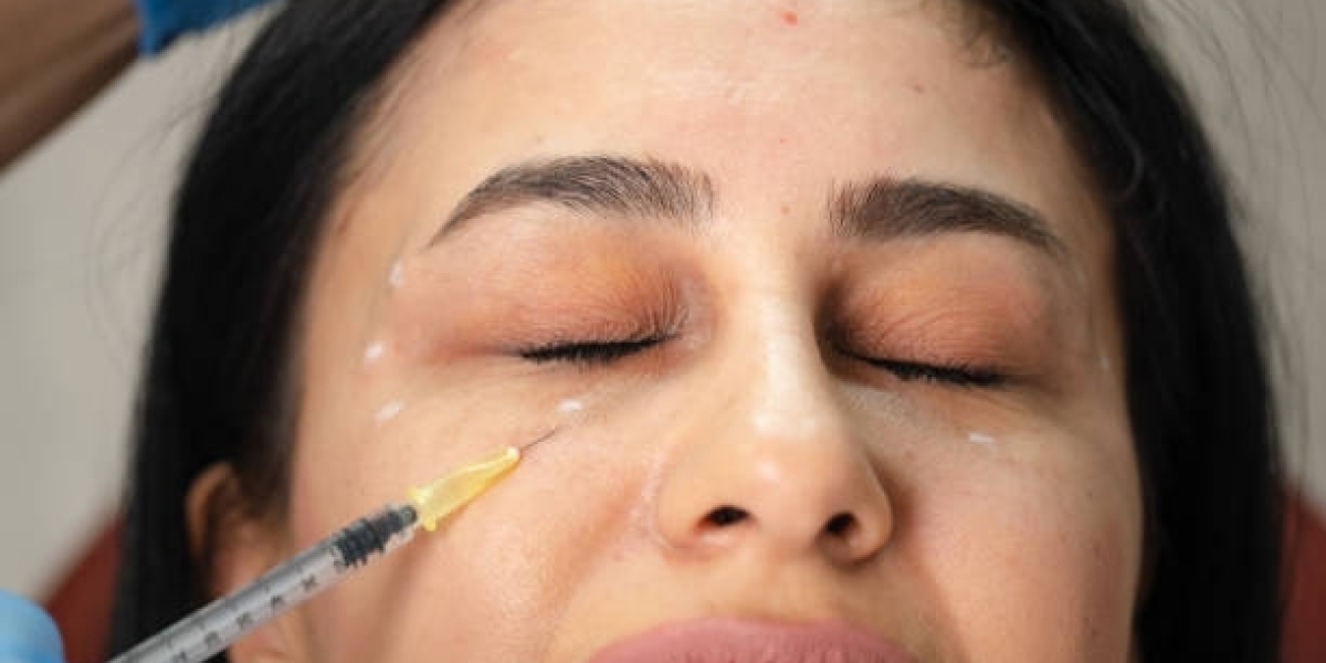 Affordable Redensity 2 Filler Injections Dubai