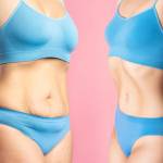 Liposuction in Riyadh Saudia Profile Picture