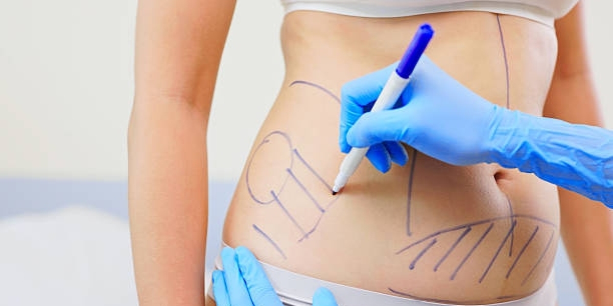 How Long Does a Liposuction Procedure Take?