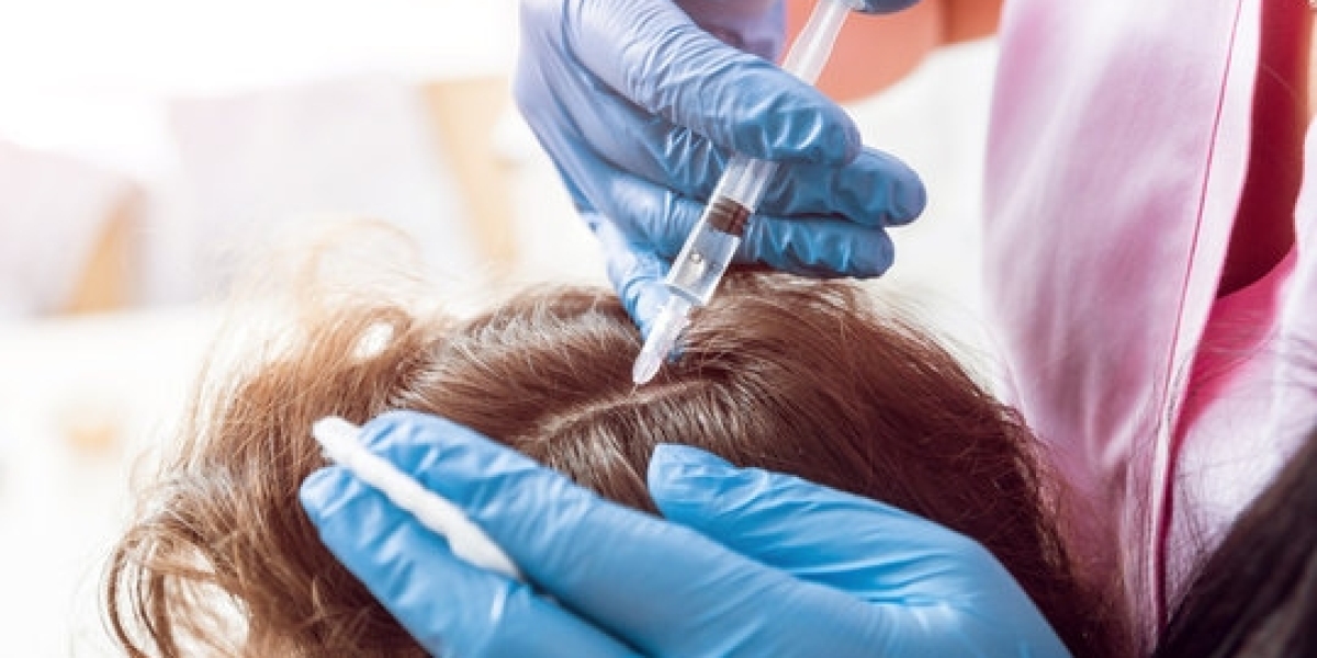 The Step by Step Process of Plasma Hair Therapy Explained