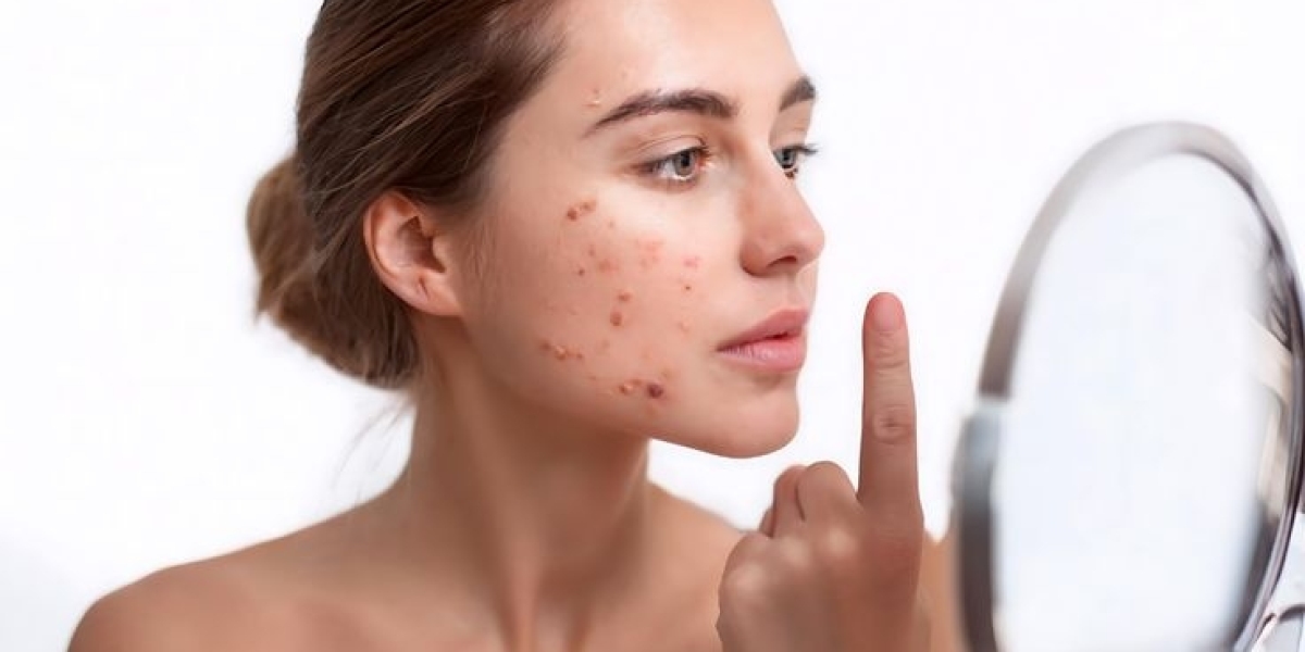 How to Spot Fake Promises in Pigmentation Treatment Offers