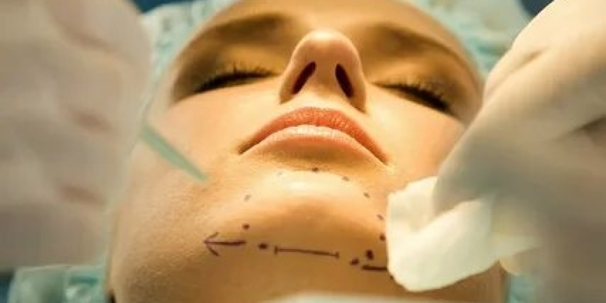 Common Myths About Cheek Augmentation Debunked