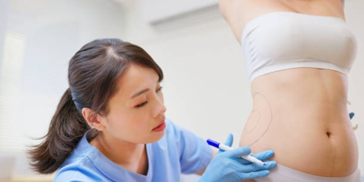 Can Fractional Liposuction Refine Thigh Gaps?