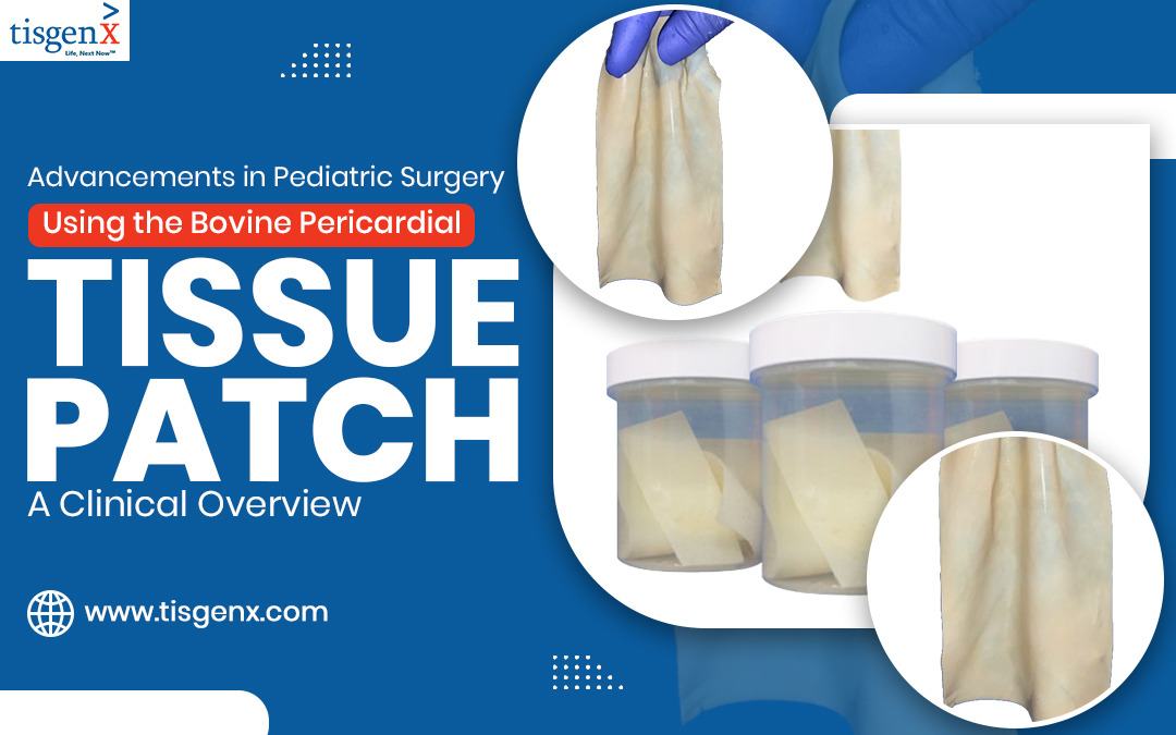 Understanding the Benefits of Bovine Pericardial Tissue in Pediatric Surgery – @tisgenx on Tumblr