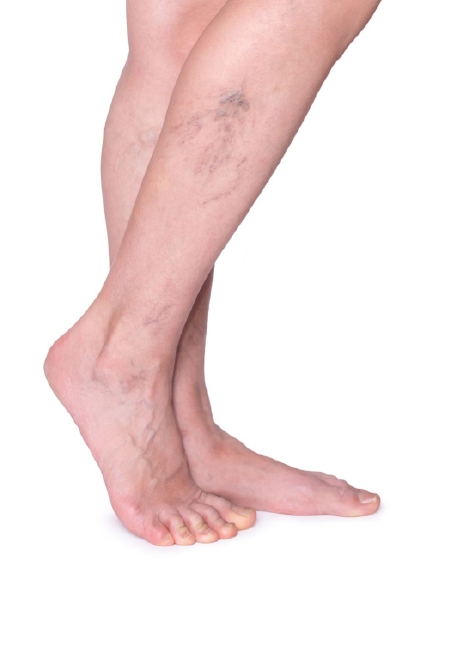 Lotuslaserskin Profile Picture