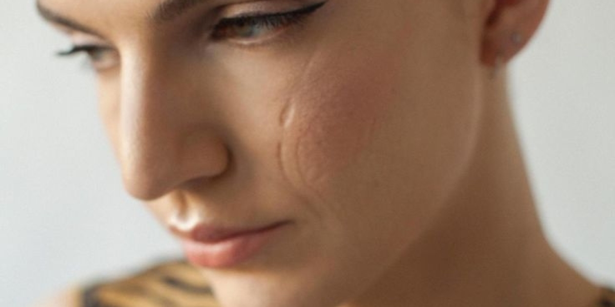 Facial Scar Revision in Islamabad: Restore Smooth Skin