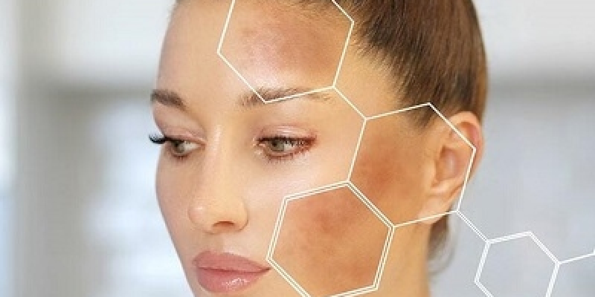 The Latest Pigmentation Removal Techniques in Islamabad