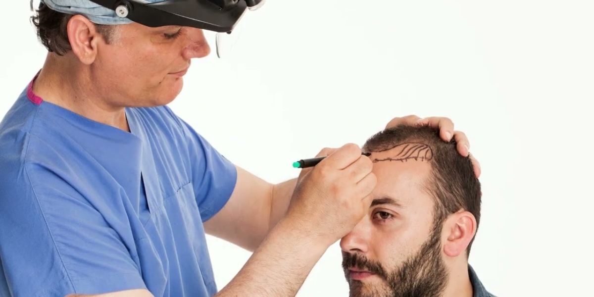 The Cost of 2,000 Grafts: Real-World Estimates in Riyadh