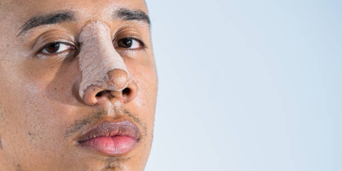 Rhinoplasty in Dubai: Recovery Tips for Optimal Results