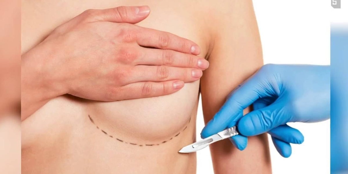 Expert Tips for a Smooth Breast Lift Surgery in Islamabad
