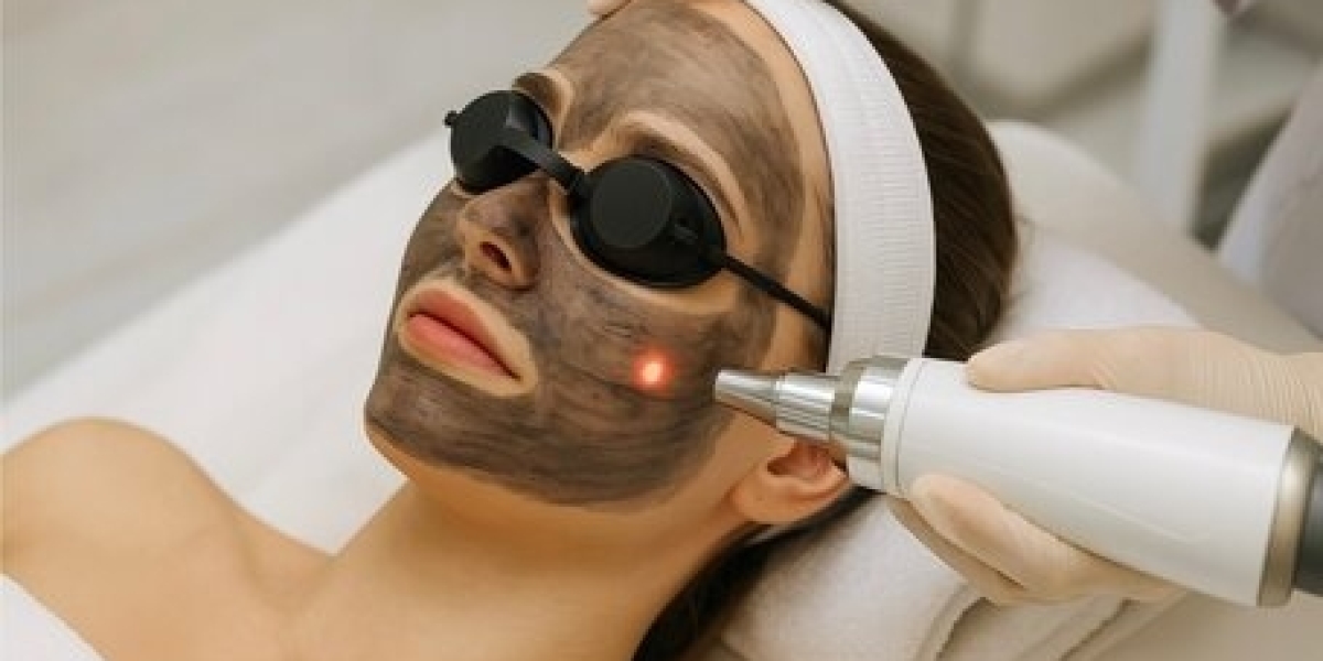 Acne Scar Treatment with Laser Carbon Therapy: What Really Works