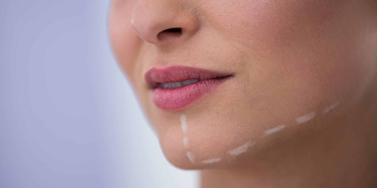 How the Type of Jaw Surgery Impacts Its Cost?